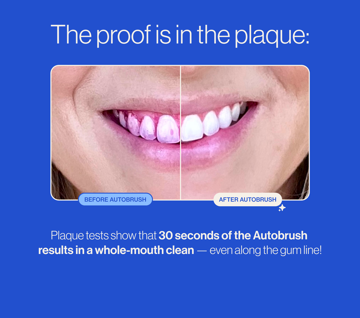 🦷U-shaped electric soft-bristled toothbrush✨